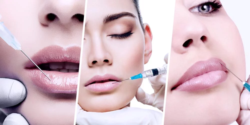 Guide to Lip Fillers in Malaysia: Enhancing Your Natural Beauty