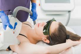 Smooth and Silky Skin with Renue MedSpa’s Laser Hair Removal